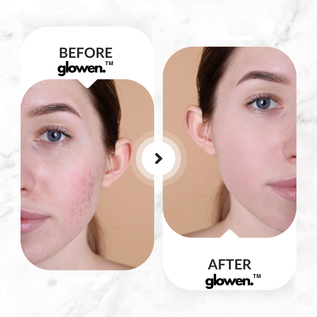 Glowen™ – Transform Your Shower, Transform Your Skin & Hair