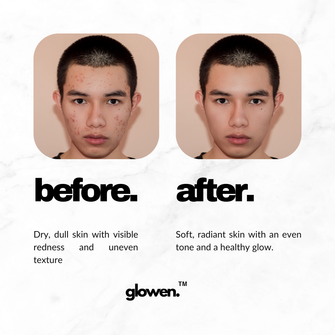 Glowen™ – Transform Your Shower, Transform Your Skin & Hair